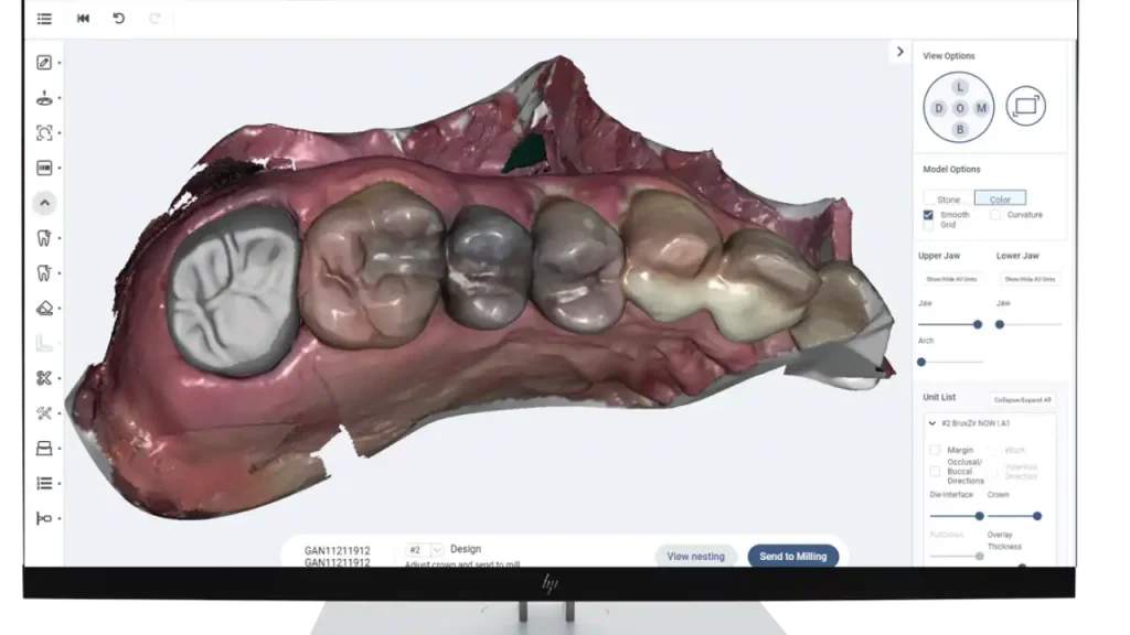 3D Dental Design Software