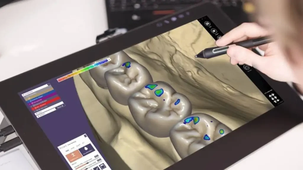 3D Dental Design Software
