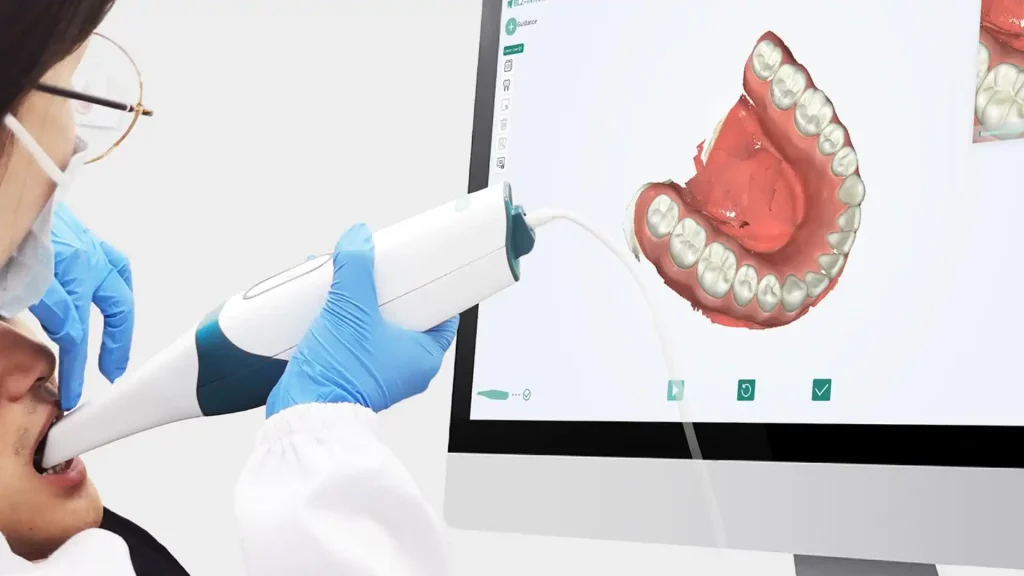 Intraoral Scanners