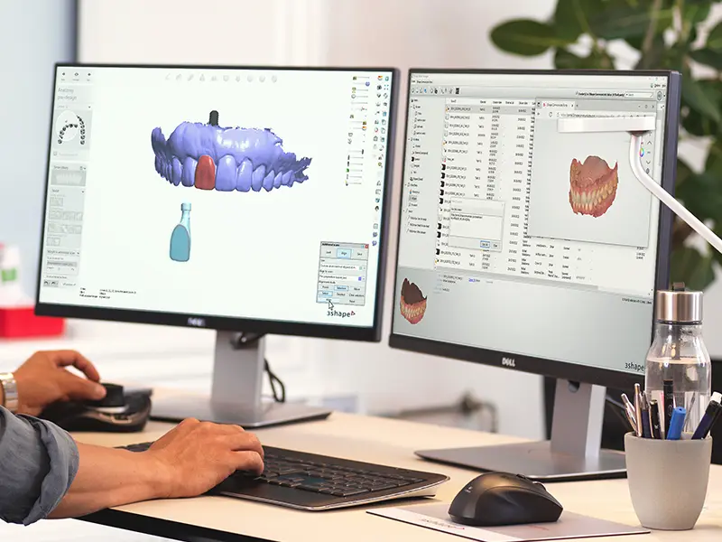 Designing an efficient digital dental workflow