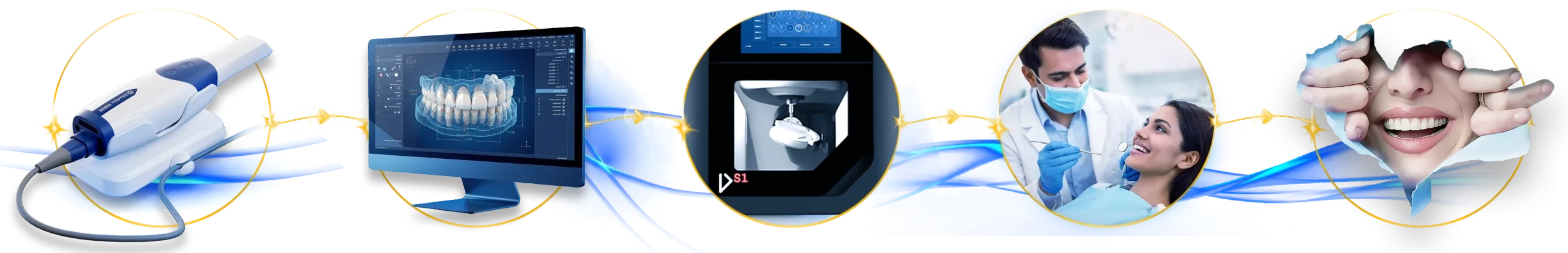 AlliedStar digital workflow from intraoral scanning to the final smile