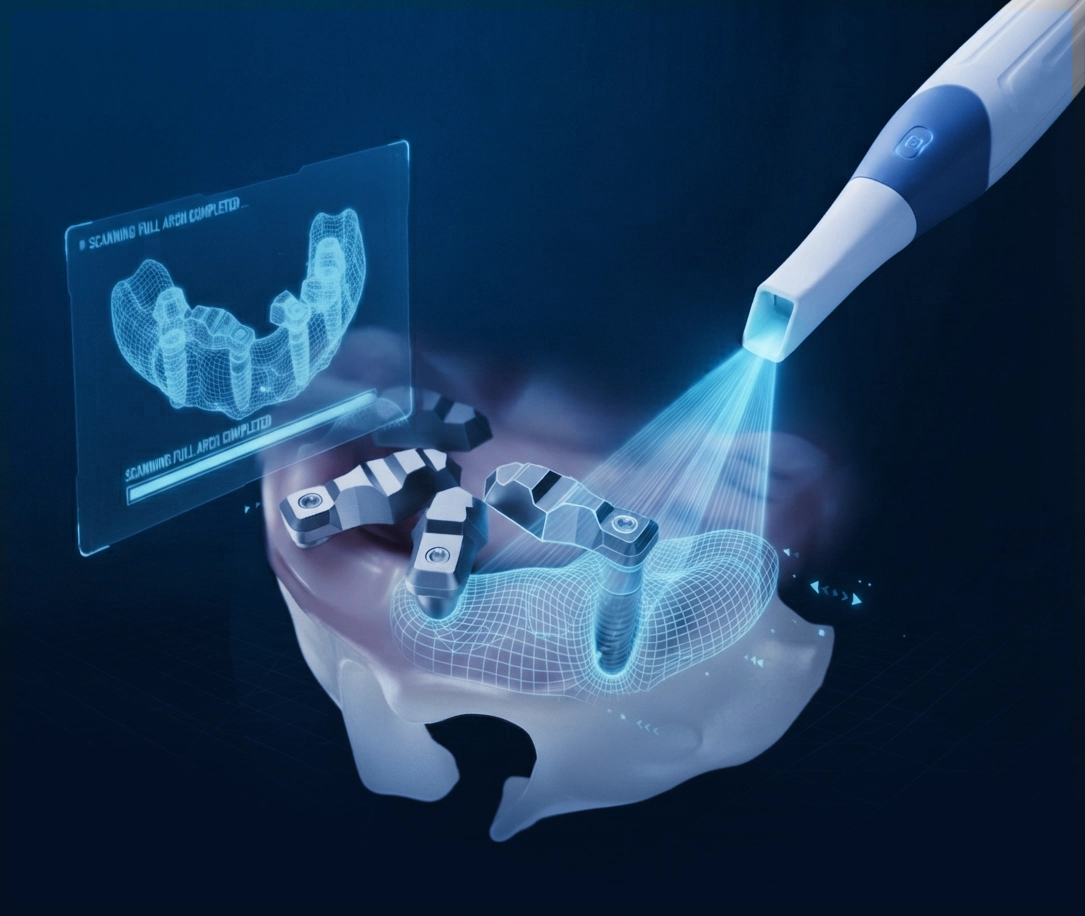 AlliedStar implant scanning workflow